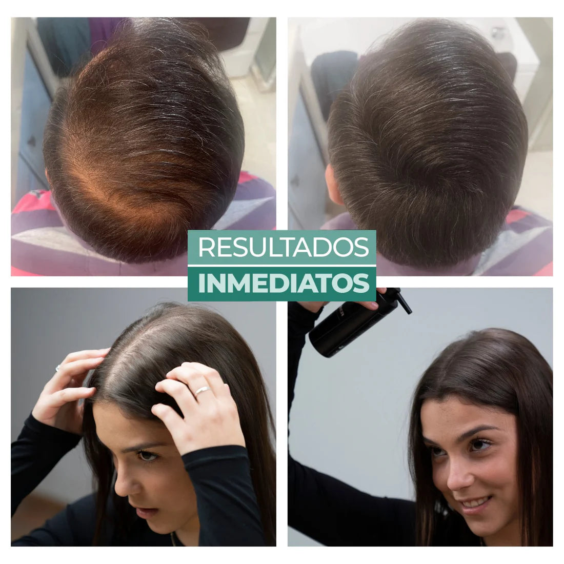 BUNEE™– Corrector de Densidad Capilar